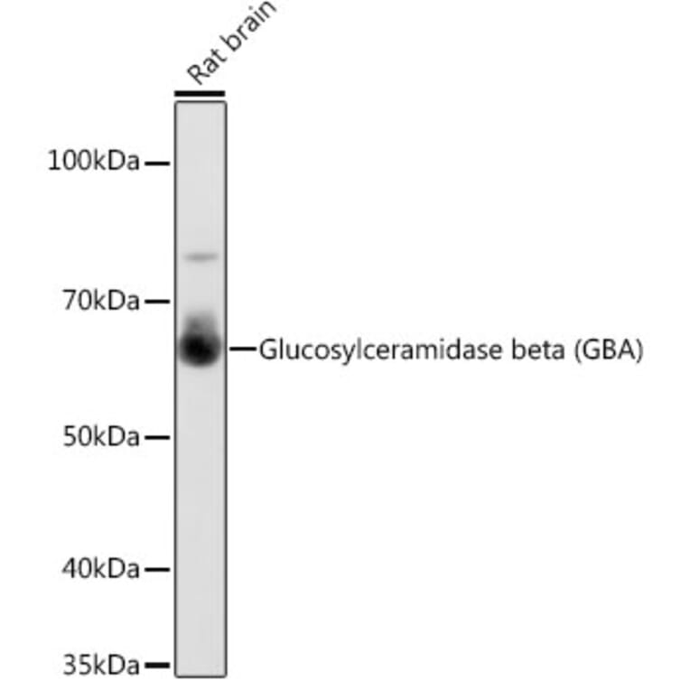 Western Blot - Anti-GBA Antibody [ARC0500] (A309031) - Antibodies.com