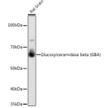 Western Blot - Anti-GBA Antibody [ARC0500] (A309031) - Antibodies.com