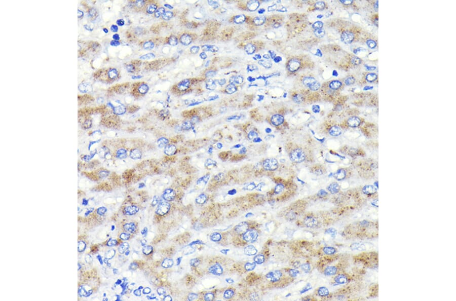 Immunohistochemistry - Anti-GBA Antibody [ARC0500] (A309031) - Antibodies.com