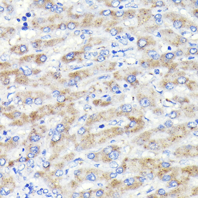 Immunohistochemistry - Anti-GBA Antibody [ARC0500] (A309031) - Antibodies.com