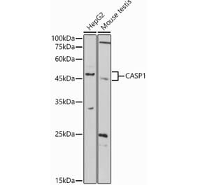 Western Blot - Anti-Caspase-1 Antibody (A309034) - Antibodies.com