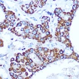 Immunohistochemistry - Anti-Caspase-1 Antibody (A309034) - Antibodies.com