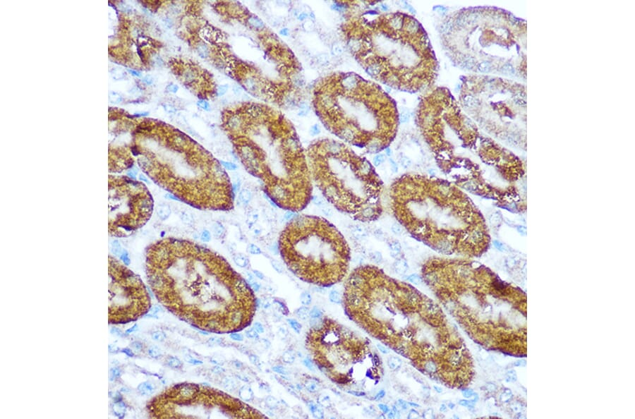 Immunohistochemistry - Anti-Caspase-1 Antibody (A309034) - Antibodies.com