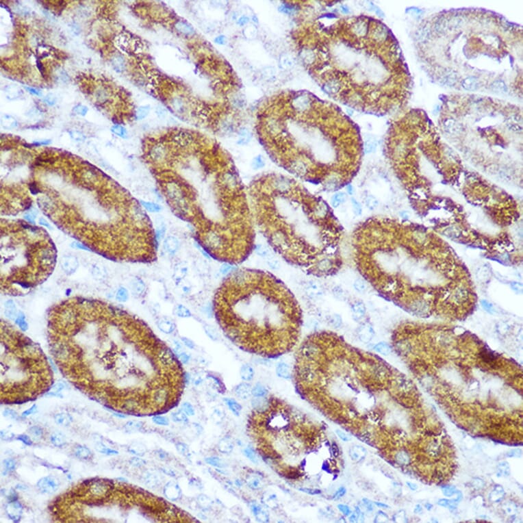 Immunohistochemistry - Anti-Caspase-1 Antibody (A309034) - Antibodies.com