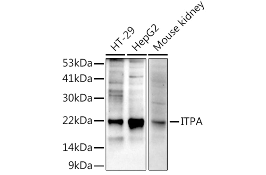 Western Blot - Anti-ITPA Antibody [ARC2773] (A309036) - Antibodies.com