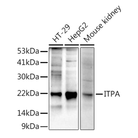 Western Blot - Anti-ITPA Antibody [ARC2773] (A309036) - Antibodies.com