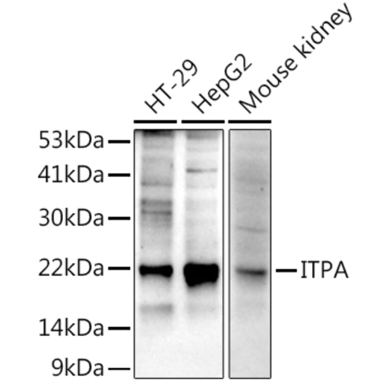Western Blot - Anti-ITPA Antibody [ARC2773] (A309036) - Antibodies.com