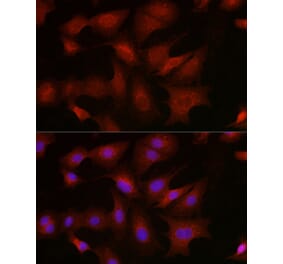 Immunofluorescence - Anti-BMPR1B Antibody (A309037) - Antibodies.com