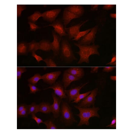 Immunofluorescence - Anti-BMPR1B Antibody (A309037) - Antibodies.com