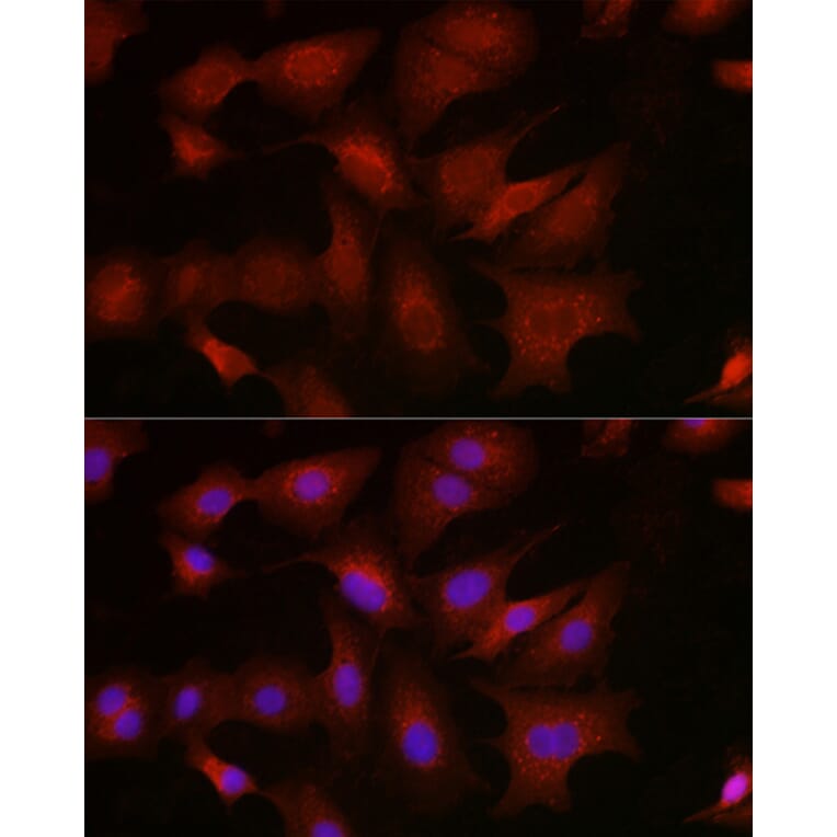 Immunofluorescence - Anti-BMPR1B Antibody (A309037) - Antibodies.com