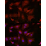 Immunofluorescence - Anti-BMPR1B Antibody (A309037) - Antibodies.com