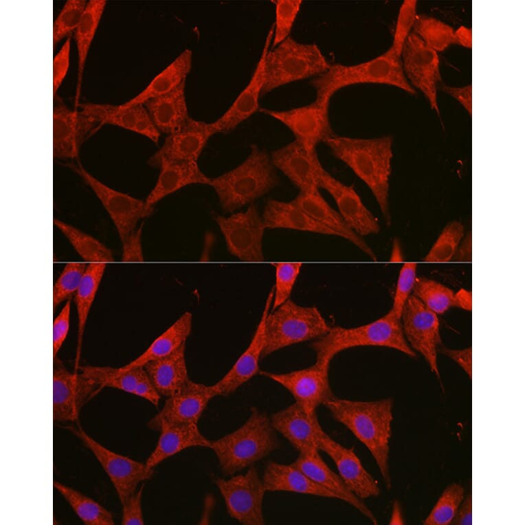 Immunofluorescence - Anti-BMPR1B Antibody (A309037) - Antibodies.com