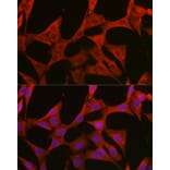 Immunofluorescence - Anti-BMPR1B Antibody (A309037) - Antibodies.com