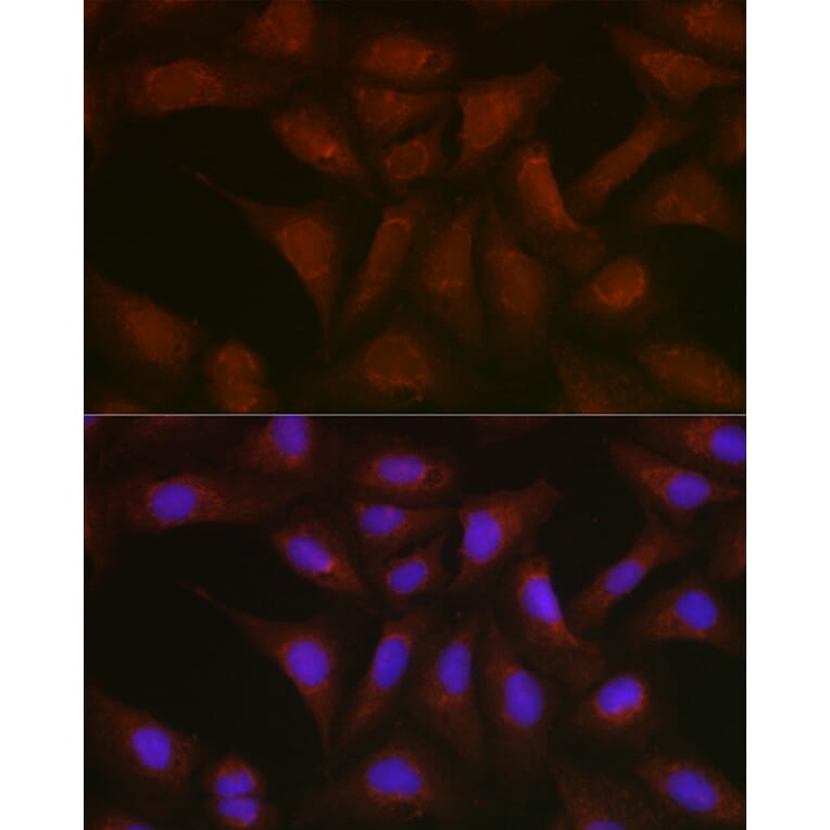 Immunofluorescence - Anti-BMPR1B Antibody (A309037) - Antibodies.com