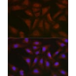 Immunofluorescence - Anti-BMPR1B Antibody (A309037) - Antibodies.com