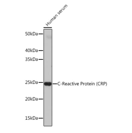 Western Blot - Anti-C Reactive Protein Antibody [ARC0341] (A309038) - Antibodies.com