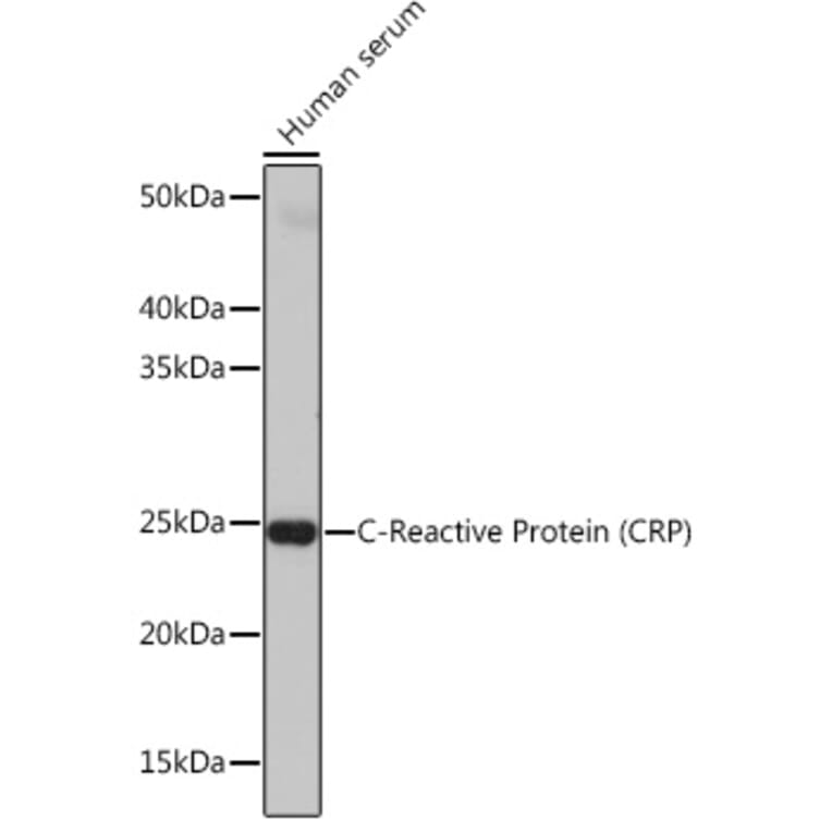 Western Blot - Anti-C Reactive Protein Antibody [ARC0341] (A309038) - Antibodies.com