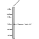 Western Blot - Anti-C Reactive Protein Antibody [ARC0341] (A309038) - Antibodies.com