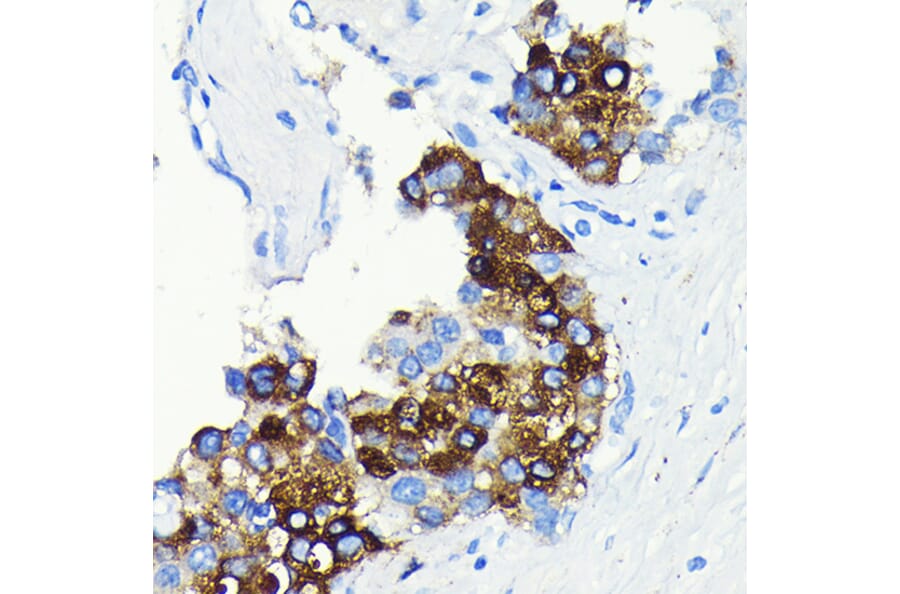 Immunohistochemistry - Anti-C Reactive Protein Antibody [ARC0341] (A309038) - Antibodies.com