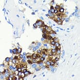 Immunohistochemistry - Anti-C Reactive Protein Antibody [ARC0341] (A309038) - Antibodies.com