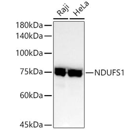 Western Blot - Anti-Ndufs1 Antibody [ARC52613] (A309039) - Antibodies.com