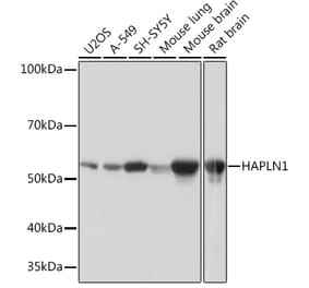 Western Blot - Anti-HAPLN1 Antibody [ARC0234] (A309042) - Antibodies.com