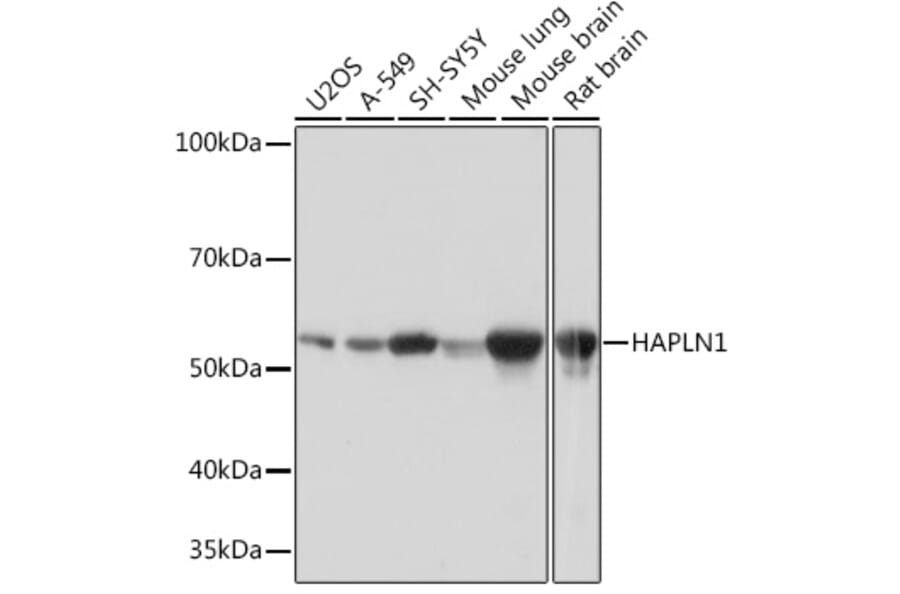 Western Blot - Anti-HAPLN1 Antibody [ARC0234] (A309042) - Antibodies.com