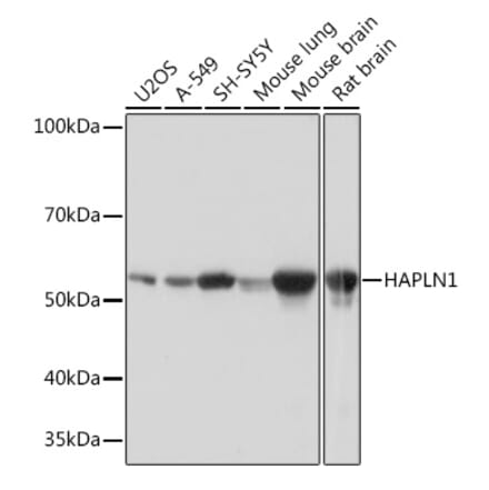 Western Blot - Anti-HAPLN1 Antibody [ARC0234] (A309042) - Antibodies.com