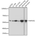 Western Blot - Anti-HAPLN1 Antibody [ARC0234] (A309042) - Antibodies.com