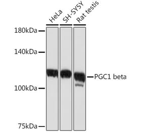 Western Blot - Anti-PGC1 beta Antibody [ARC2136] (A309043) - Antibodies.com