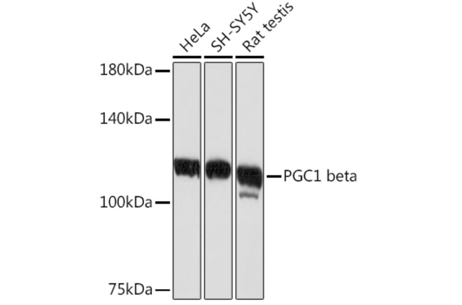 Western Blot - Anti-PGC1 beta Antibody [ARC2136] (A309043) - Antibodies.com