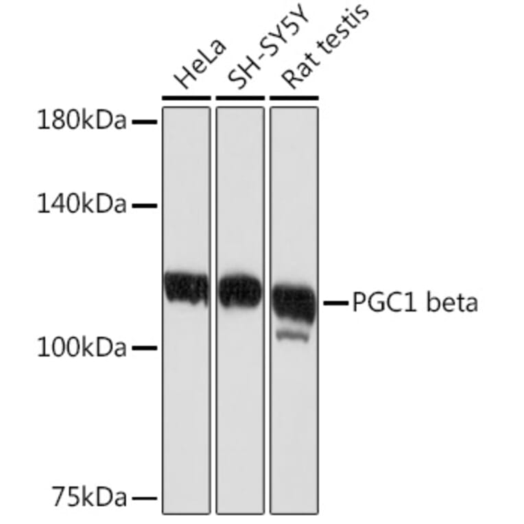 Western Blot - Anti-PGC1 beta Antibody [ARC2136] (A309043) - Antibodies.com