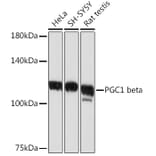 Western Blot - Anti-PGC1 beta Antibody [ARC2136] (A309043) - Antibodies.com