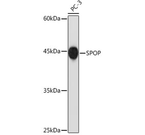 Western Blot - Anti-SPOP Antibody [ARC2181] (A309045) - Antibodies.com