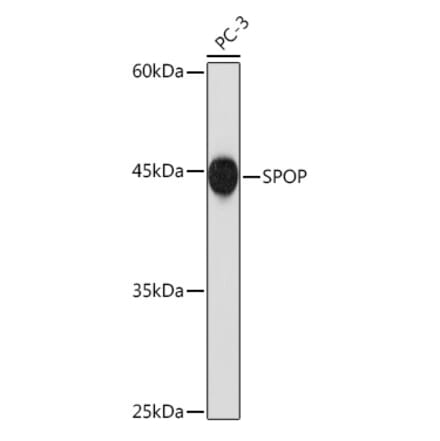 Western Blot - Anti-SPOP Antibody [ARC2181] (A309045) - Antibodies.com