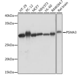 Western Blot - Anti-PSMA3 Antibody [ARC1234] (A309046) - Antibodies.com