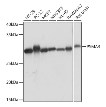 Western Blot - Anti-PSMA3 Antibody [ARC1234] (A309046) - Antibodies.com