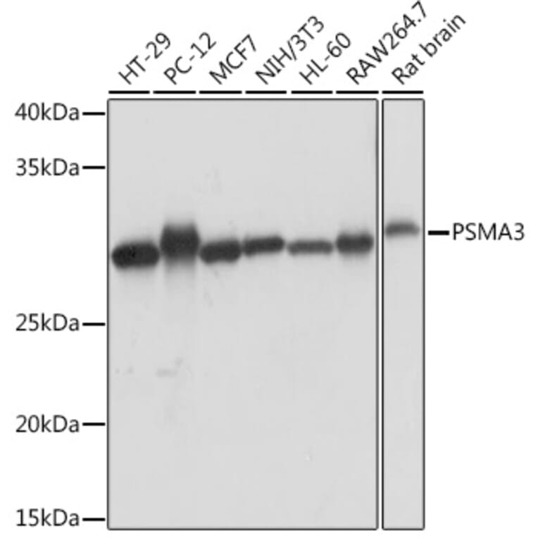 Western Blot - Anti-PSMA3 Antibody [ARC1234] (A309046) - Antibodies.com