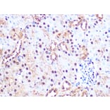 Immunohistochemistry - Anti-PSMA3 Antibody [ARC1234] (A309046) - Antibodies.com