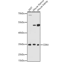 Western Blot - Anti-Cdk4 Antibody (A309050) - Antibodies.com