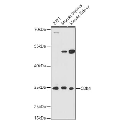 Western Blot - Anti-Cdk4 Antibody (A309050) - Antibodies.com