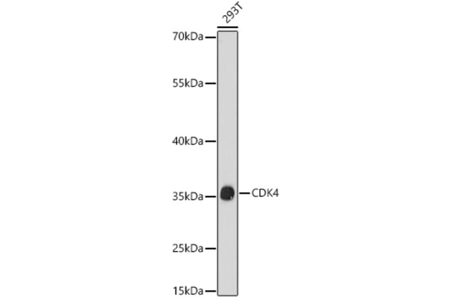 Western Blot - Anti-Cdk4 Antibody (A309050) - Antibodies.com