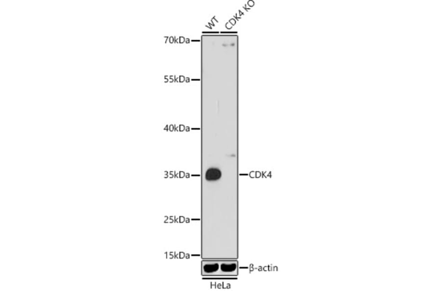 Western Blot - Anti-Cdk4 Antibody (A309050) - Antibodies.com