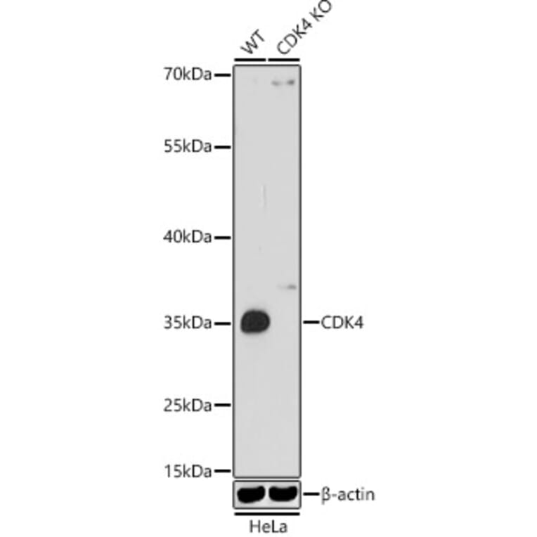 Western Blot - Anti-Cdk4 Antibody (A309050) - Antibodies.com