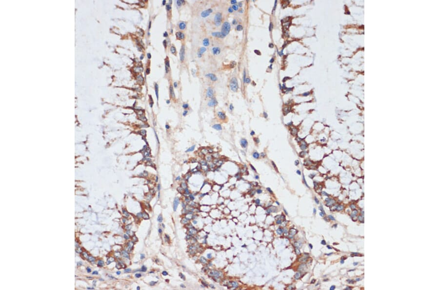Immunohistochemistry - Anti-Cdk4 Antibody (A309050) - Antibodies.com