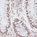 Immunohistochemistry - Anti-Cdk4 Antibody (A309050) - Antibodies.com