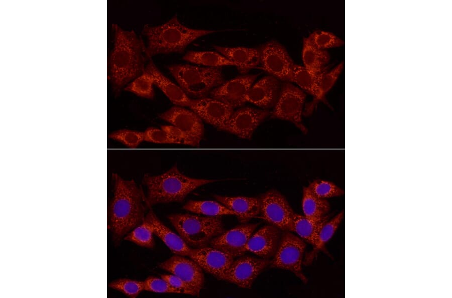 Immunofluorescence - Anti-Cdk4 Antibody (A309050) - Antibodies.com