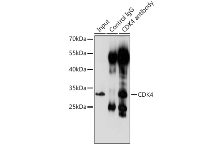 Western Blot - Anti-Cdk4 Antibody (A309050) - Antibodies.com