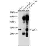 Western Blot - Anti-Cdk4 Antibody (A309050) - Antibodies.com