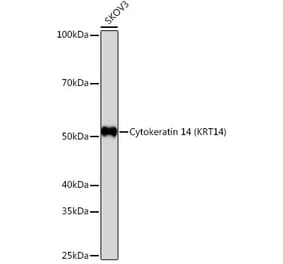 Western Blot - Anti-Cytokeratin 14 Antibody [ARC0351] (A309051) - Antibodies.com